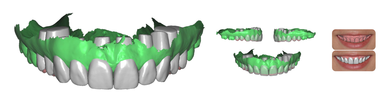 Studie & Ontwerp - Digital Smile Design
